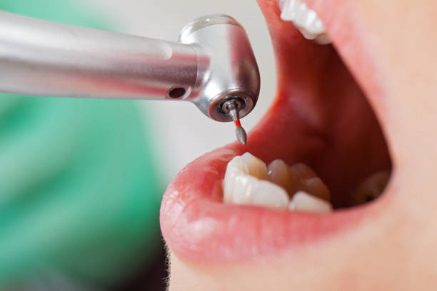 Best Cosmetic Emergency Dentistry in Chickamau, GA
